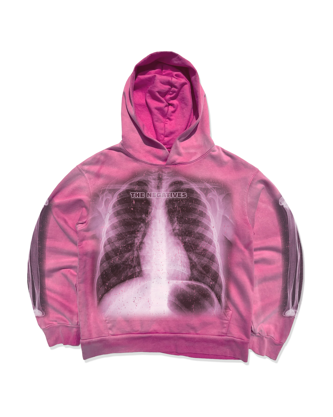 Xoxo X-rays kisses Hoodie