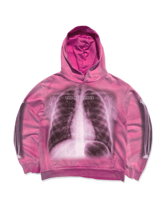 Xoxo X-rays kisses Hoodie