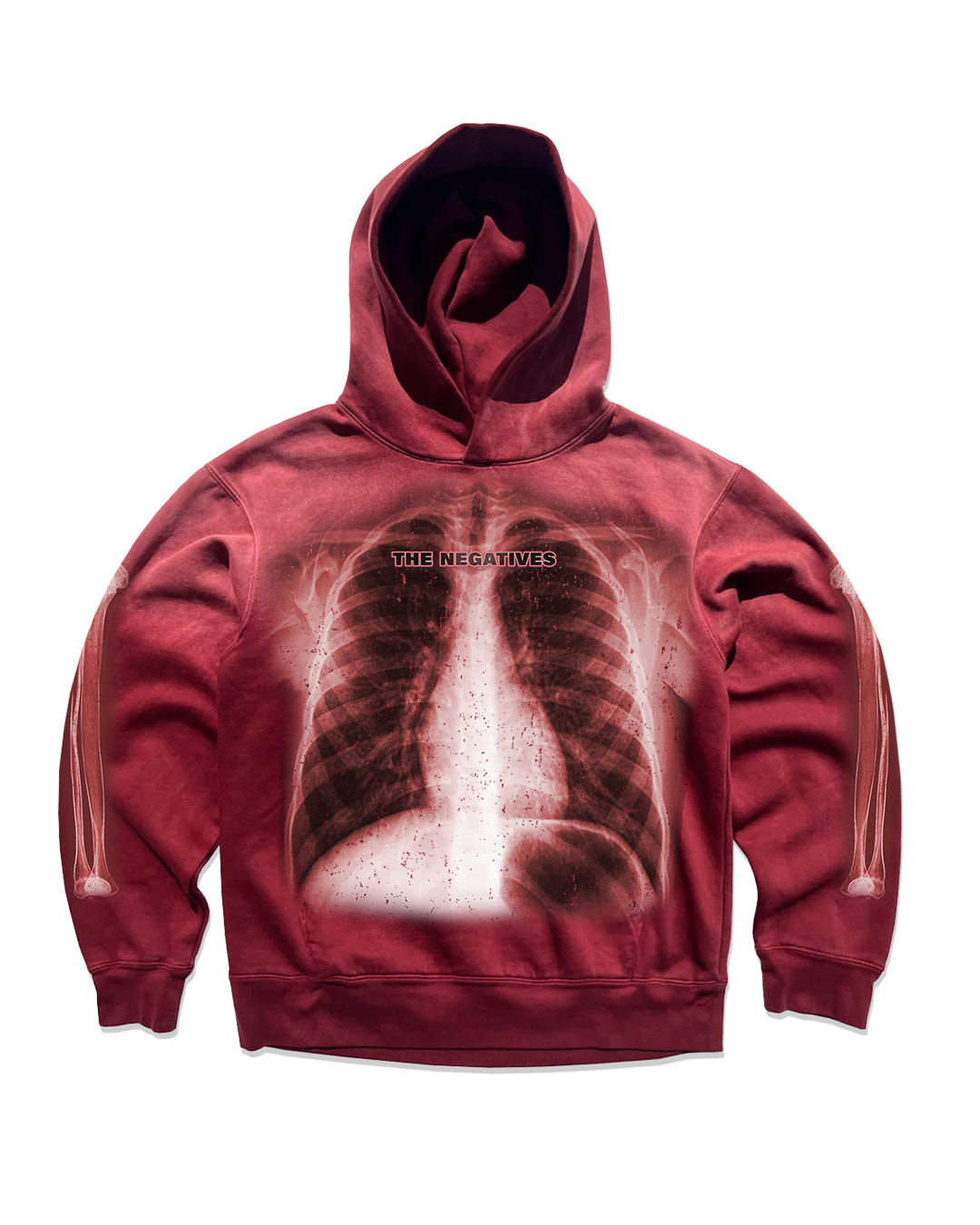 Xoxo X-rays  Hugs Hoodie