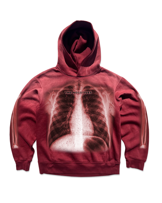 Xoxo X-rays  Hugs Hoodie